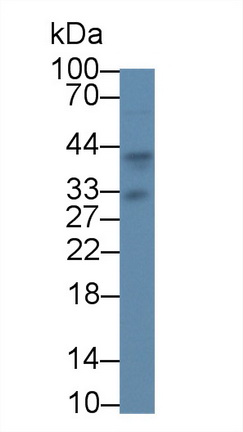 14196