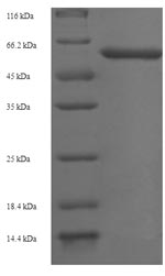 SDS-PAGE