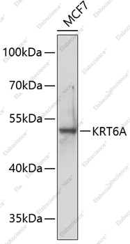 Вестерн-блоттинг, KRT6A, клетки MCF-7