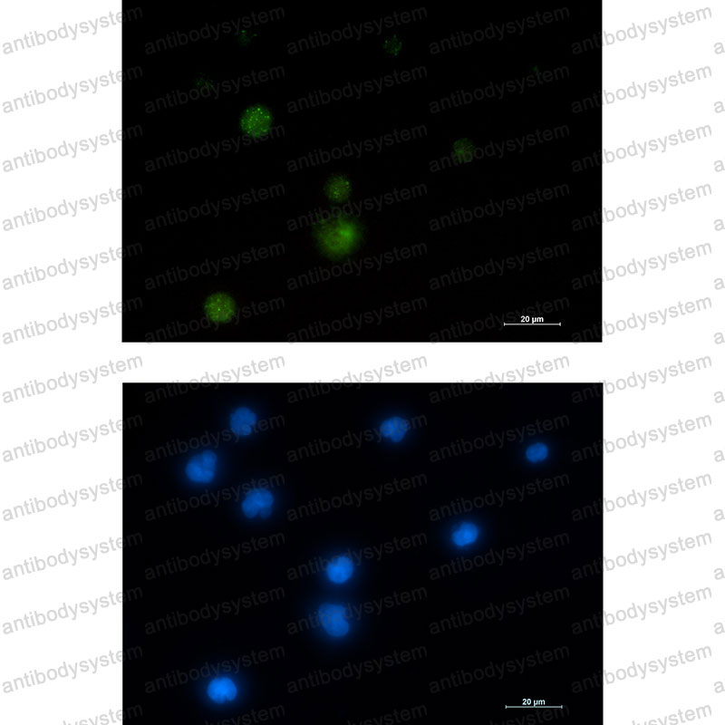 Валидация IF - AntibodySystem RHN83701