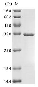 SDS-PAGE