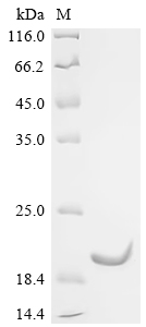 SDS-PAGE
