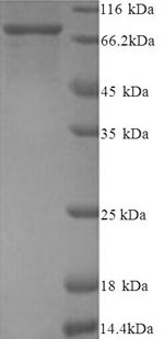 SDS-PAGE