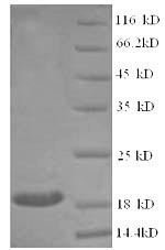 SDS-PAGE