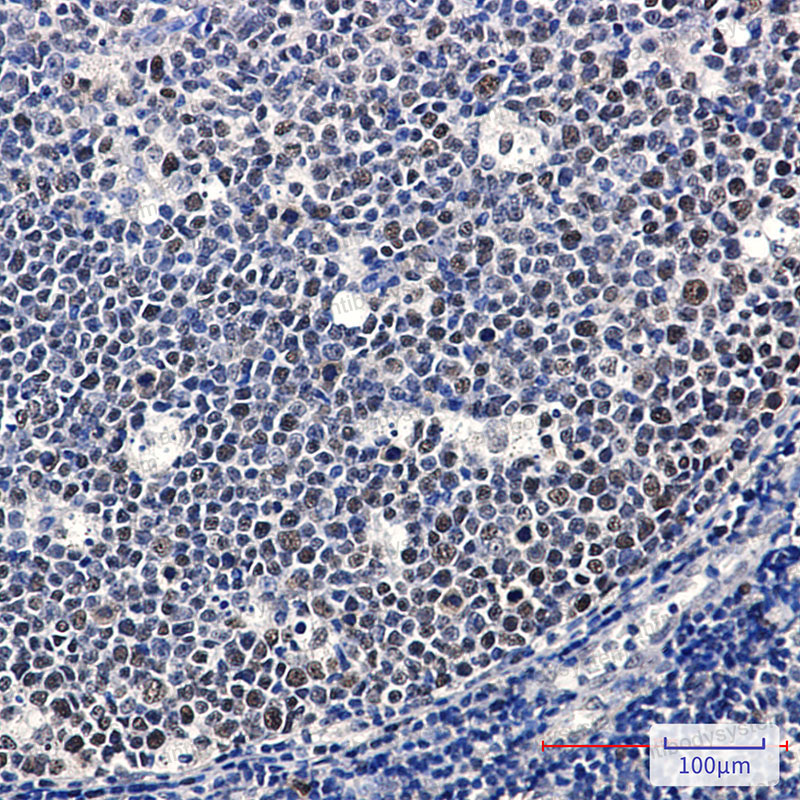 Валидация AntibodySystem RHE68801