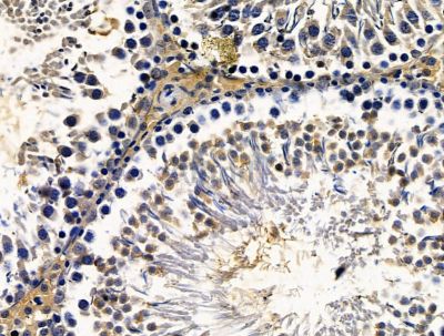 Валидация Affinity DF15622 - 12054