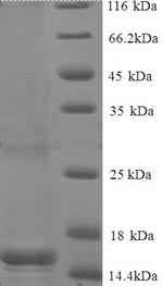 SDS-PAGE