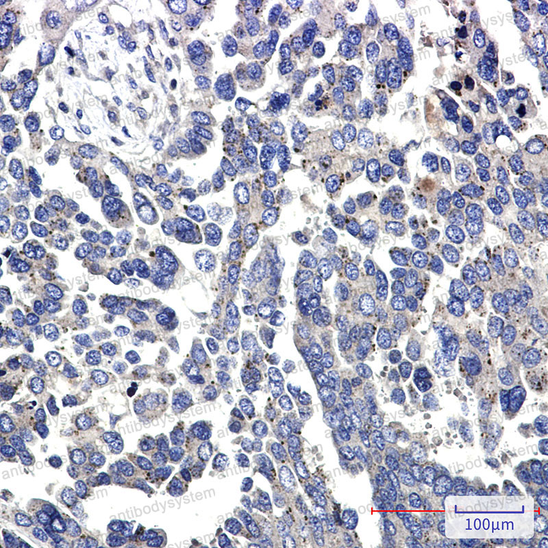 Валидация AntibodySystem RHG04701