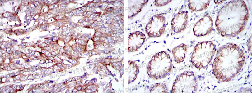 Валидация AntibodySystem RHC36005