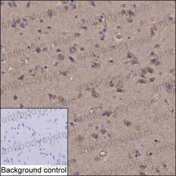 Валидация AntibodySystem RHC05203 (569)