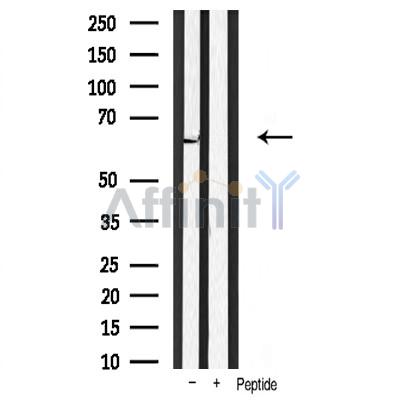 Валидация Affinity AF6018 - 3208
