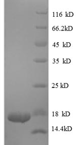 SDS-PAGE
