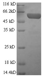 SDS-PAGE
