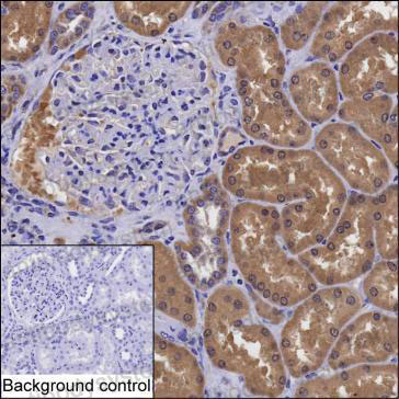 Валидация AntibodySystem RHP11901