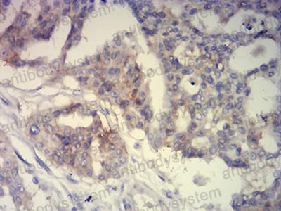 Валидация AntibodySystem RHE79002