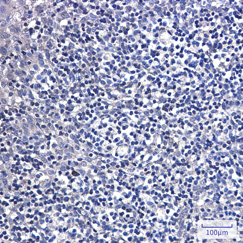 Валидация AntibodySystem RHD60701