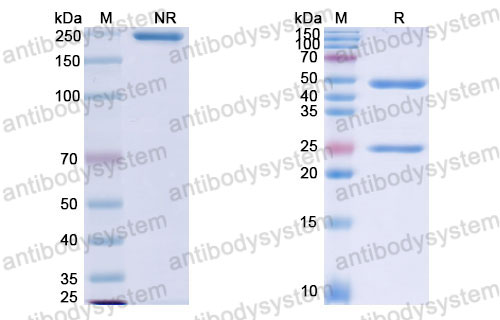 Валидация SDS-PAGE - AntibodySystem DHJ70111