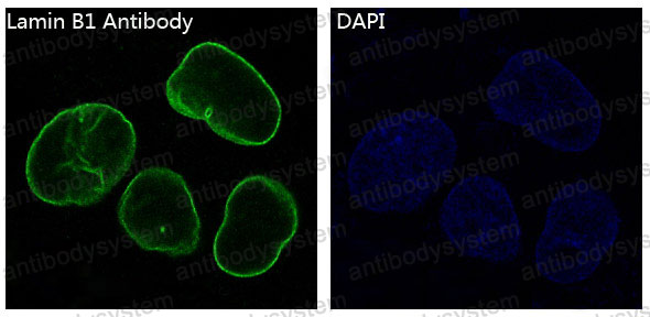 Валидация IF - AntibodySystem RHD40901
