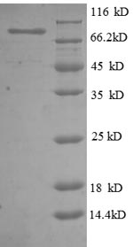 SDS-PAGE