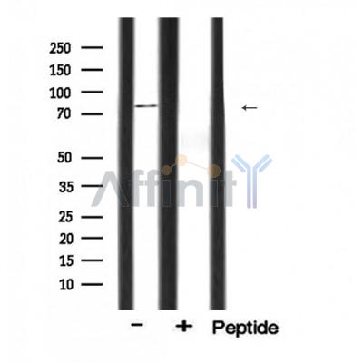 Валидация Affinity DF6100 - 17314