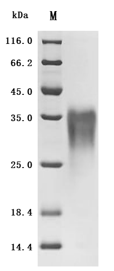 SDS-PAGE