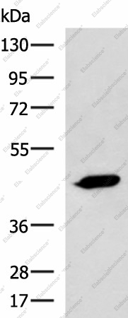 Вестерн-блоттинг, ASB10, клетки A431