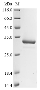 SDS-PAGE