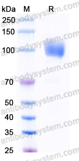 EHC42201, SDS-PAGE