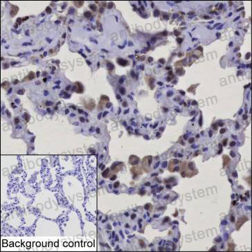 Валидация AntibodySystem RHB50801