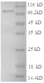 SDS-PAGE