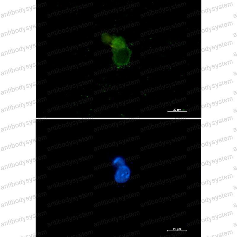 Валидация IF - AntibodySystem RHE51501