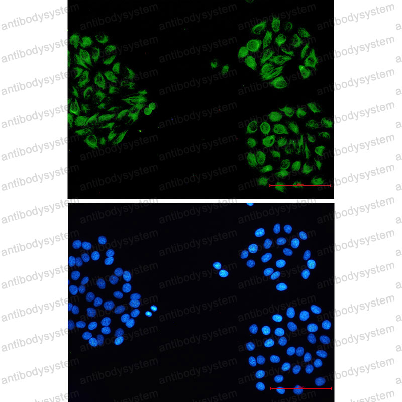 Валидация IF - AntibodySystem RHH25901