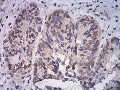 Валидация AntibodySystem RHD31103 (1467)