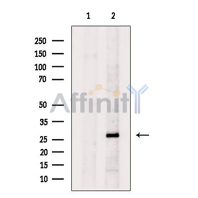 Валидация Affinity DF9956 - 22972