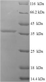 SDS-PAGE