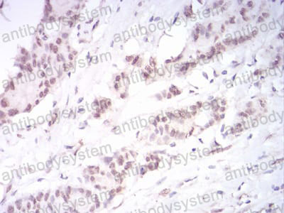 Валидация AntibodySystem RHJ72202 (3532)