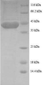 SDS-PAGE