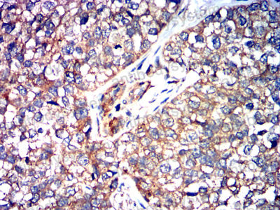 Валидация AntibodySystem RHK13702