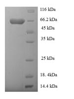 SDS-PAGE