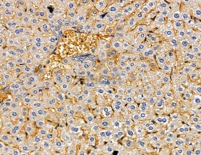 Валидация Affinity DF2612 - 13302