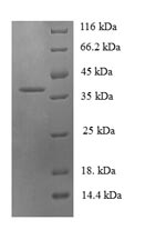 SDS-PAGE