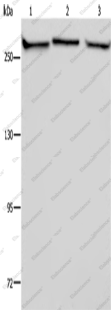 Вестерн-блоттинг, FLNA, клетки PC3, NIH/3T3 и HUVEB