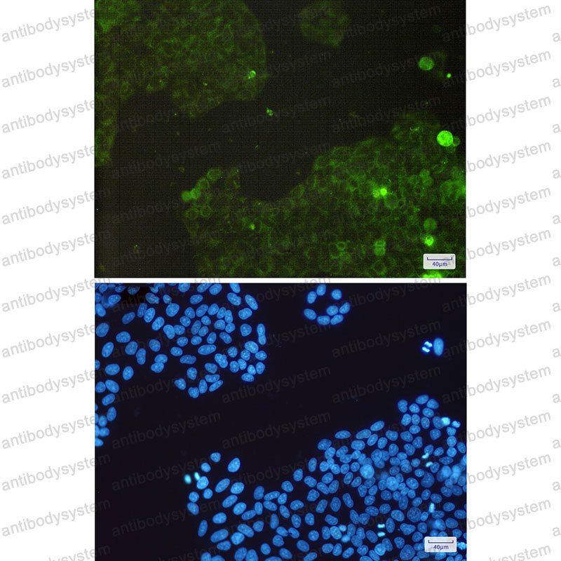 Валидация IF - AntibodySystem RHC05302