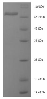 SDS-PAGE