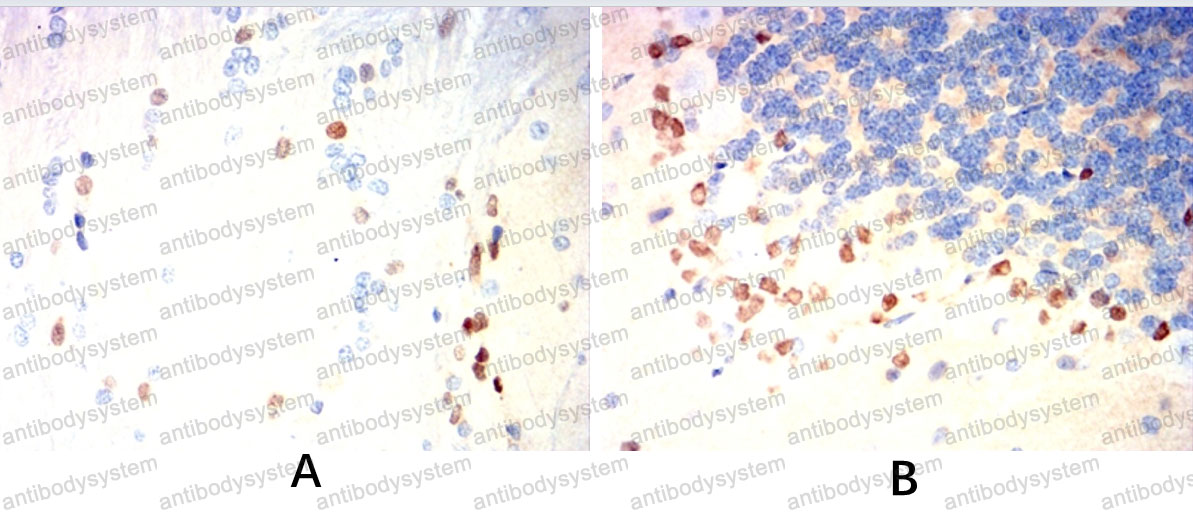 Валидация AntibodySystem RHE57501 (2226)