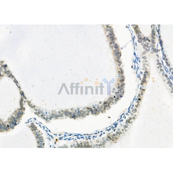 Валидация Affinity DF8544 - 20432