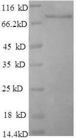 SDS-PAGE