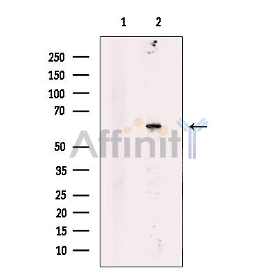 Валидация Affinity DF12314 - 6700