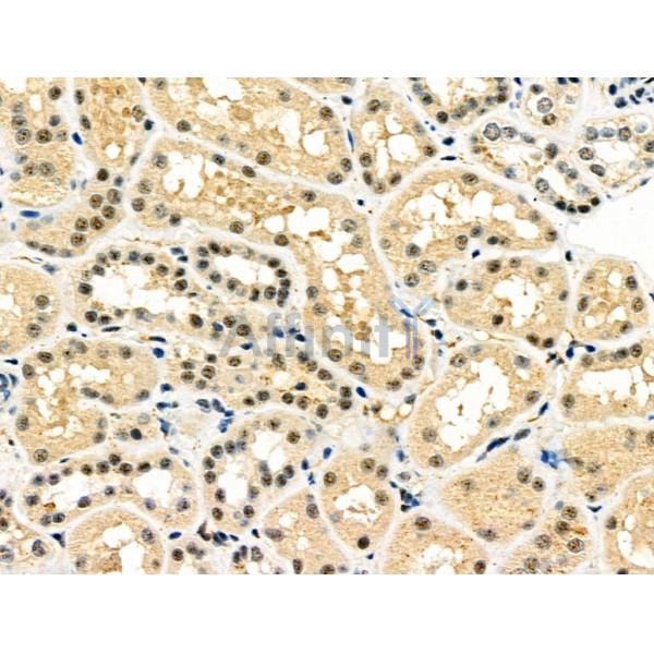 Валидация Affinity DF6331 - 17661