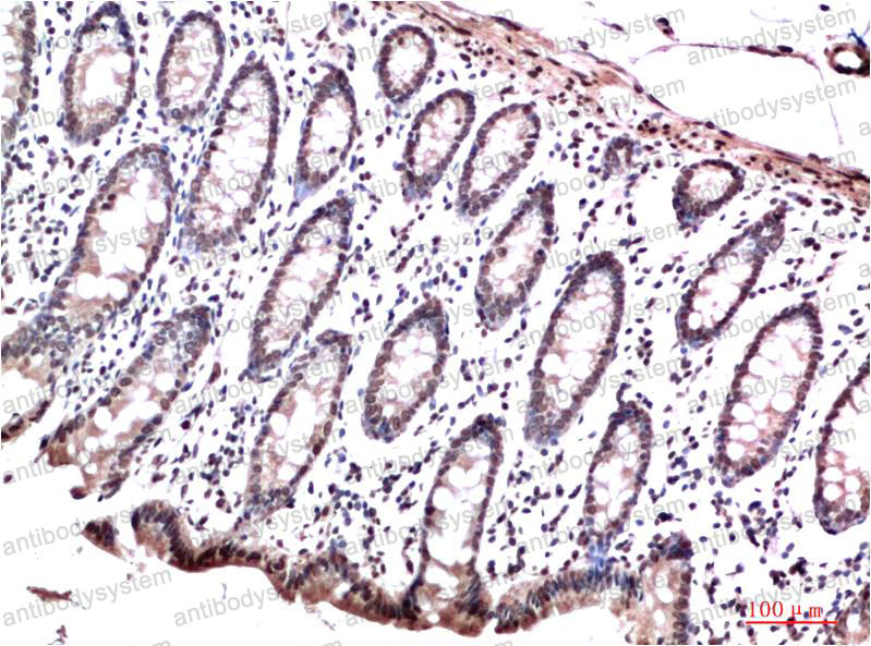 Валидация AntibodySystem RHG43406